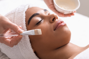 Chemical Peel