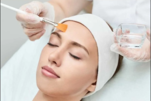 Custom Chemical Peel