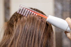 High Frequency for Hair Growth
