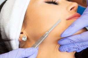 Dermaplaning