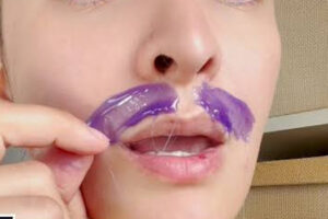 Upper Lip